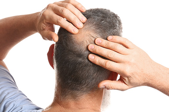 Sente queda de cabelo intensa? Conheça as razões e como combatê-la.